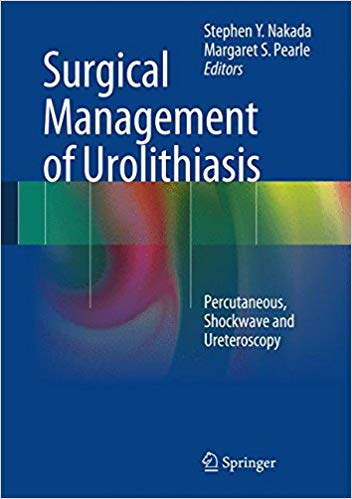 Surgical Management of Urolithiasis: Percutaneous, Shockwave and Ureteroscopy